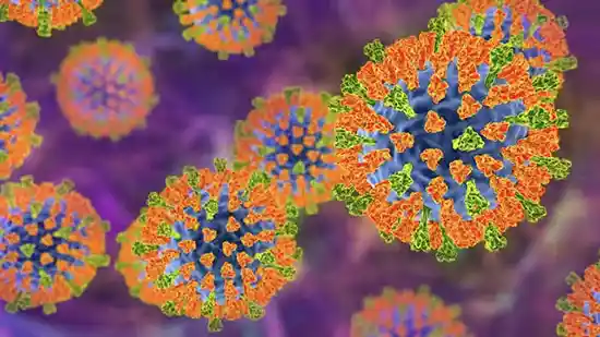 measles 